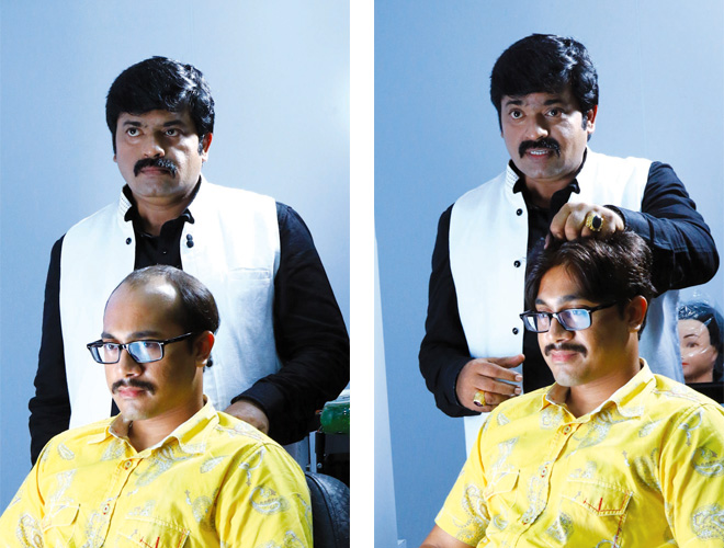 Hairfixing, Hair replacement, Beauty care in Bangalore | Kerala | Delhi