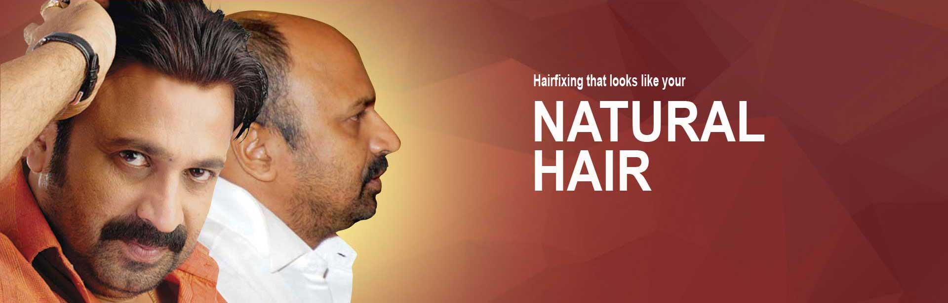 Gateway Beaumondes Hair Replacement Hairfixing in Bangalore